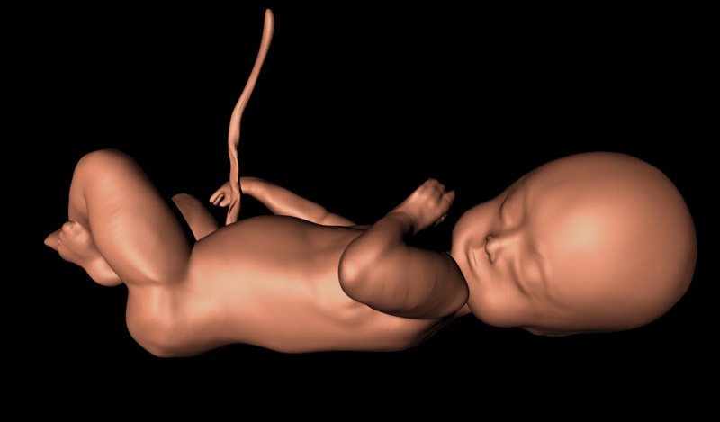 In-Virto Fetus preview image 1